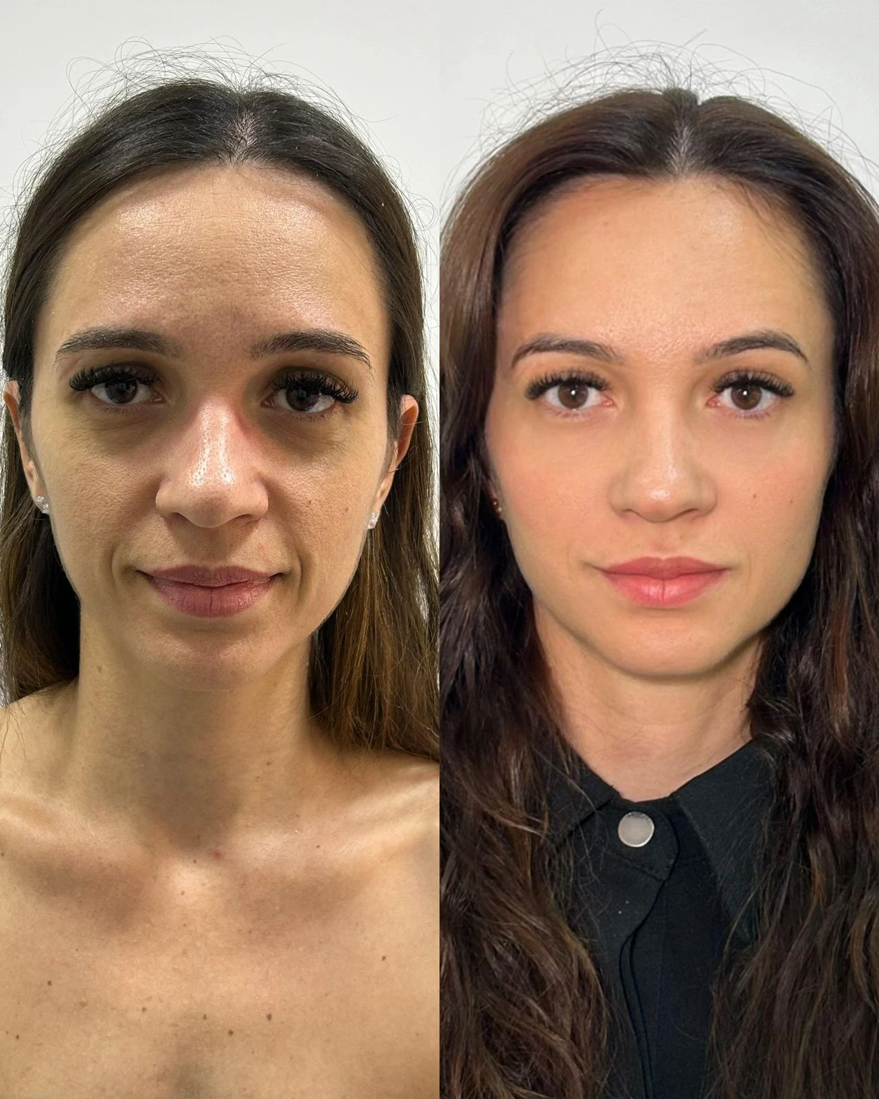 Antes e depois 2